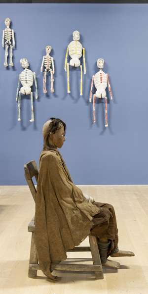 Collector&#8217;s exhibition views death through artists&#8217; eyes