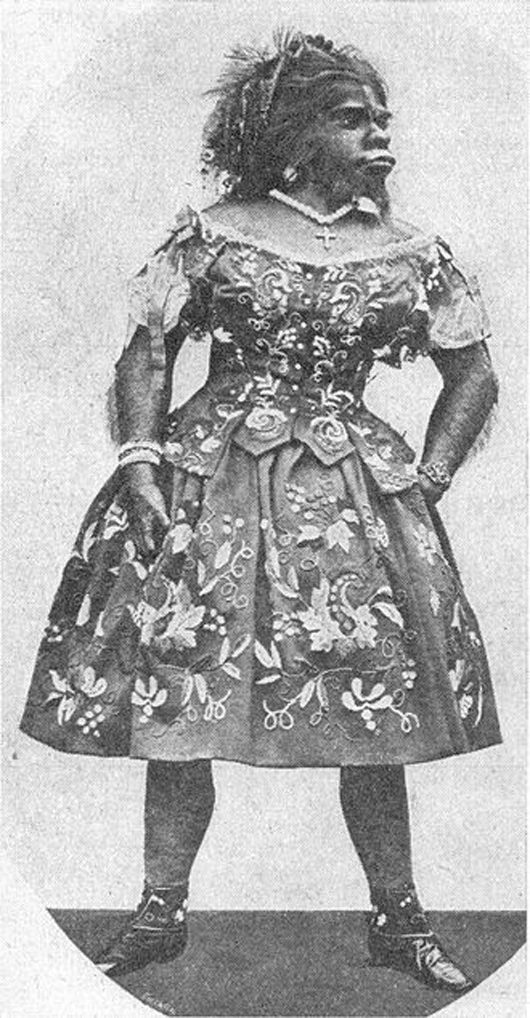 Julia Pastrana, image from a 1900 book, showing her embalmed remains. Image courtesy of Wikimedia Commons.