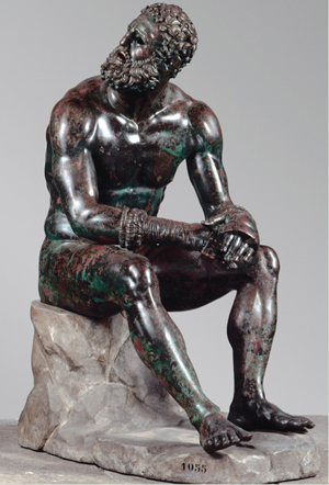 Boxer at Rest,' Greek, Hellenistic period, late fourth-seond century B.C. Bronze with copper inlays. Museo Nazionale Romano – Palazzo Massimo alle Terme, Rome, inv. 1055. Lent by the Republic of Italy. Image courtesy Soprintendenza Speciale per i Beni Archeologici di Roma – Museo Nazionale Romano – Palazzo Massimo alle Terme.