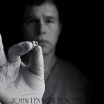 Dr. Michael Zuk with John Lennon's molar purchased at a UK auction in 2010. Wire service photo.