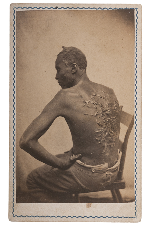 Rare CDV of the Escaped Slave ‘Gordon’ displaying his scars. Price realized: $13,200. Cowan’s Auctions Inc. image.