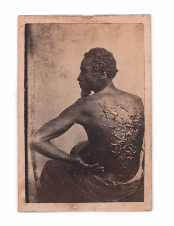 Anti-slavery carte-de-visite dubbed ‘The Scourged Back,’ estimated at $7,500-$12,500